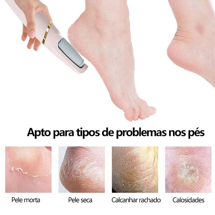 Lixa Elétrica para Pés Soft Skin